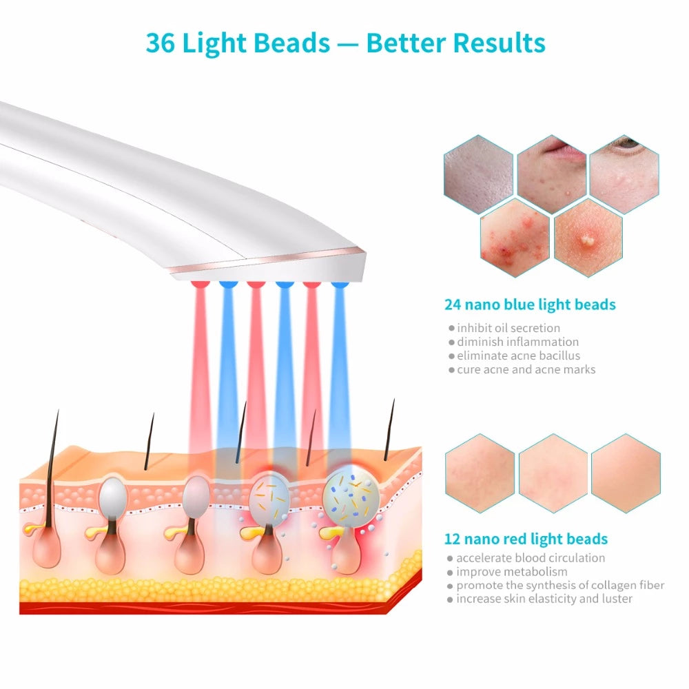 Wireless Rechargeable Light Ray Acne Eraser