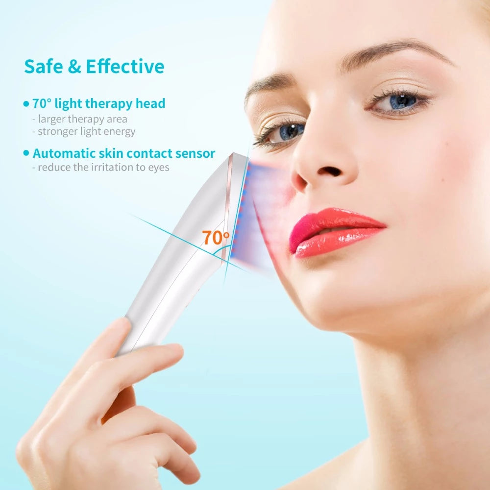 Wireless Rechargeable Light Ray Acne Eraser
